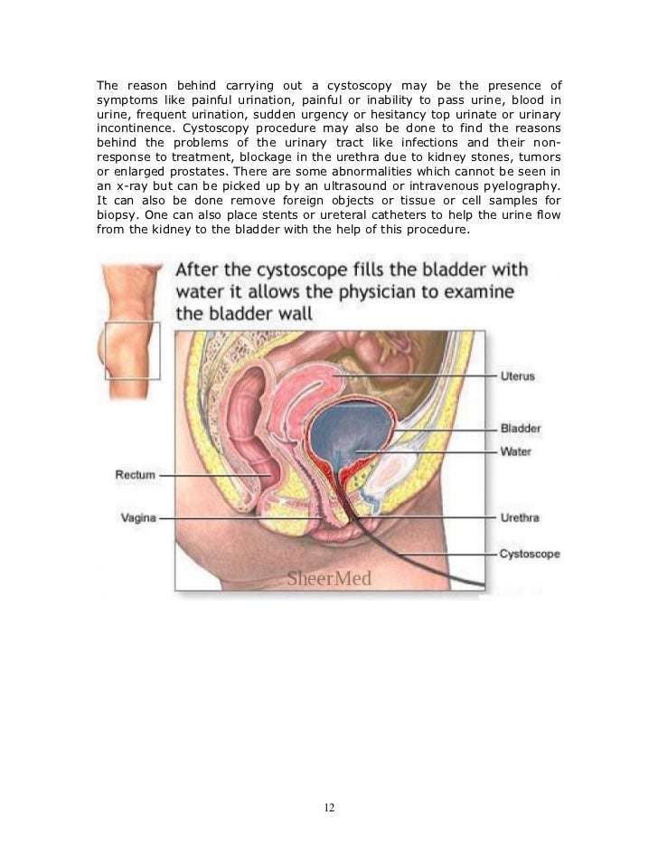 Shaved labia history Efinition of a hustler lyrics